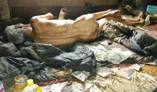 山东平度"皮包骨"老人离世 享受低保不满一月