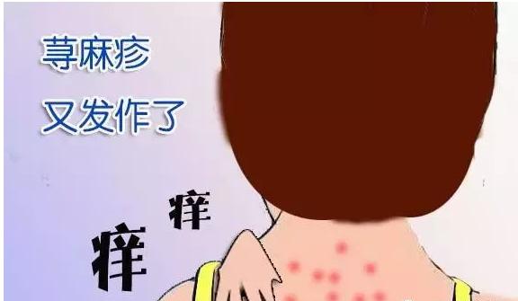 烦人的荨麻疹总复发?如何正确应对?你真的懂吗?牢记三