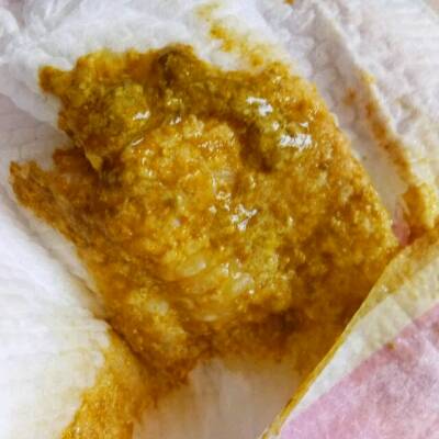 宝宝大便有好几天这样了,这是受凉还是消化不良,求助