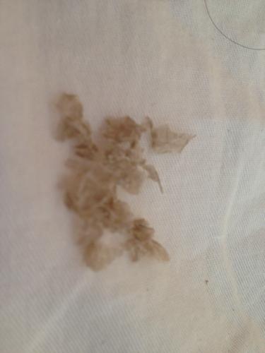 昨天晚上发现 阴囊脱皮像似蛇皮一样怎么回似