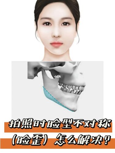 拍照时,大小脸怎么办?_咬肌_摄影_颧骨_下颌角_大小脸