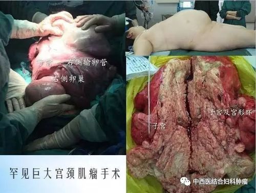 广东省中医院大学城妇科欢迎您—进修医生招生简章