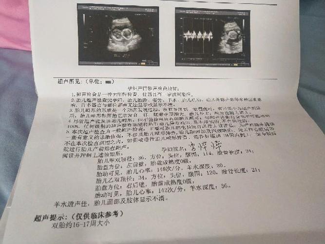 双绒双羊有可能是龙凤胎吗