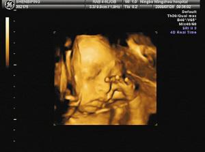 三维彩超一号难求 有的医院预约号已排到明年