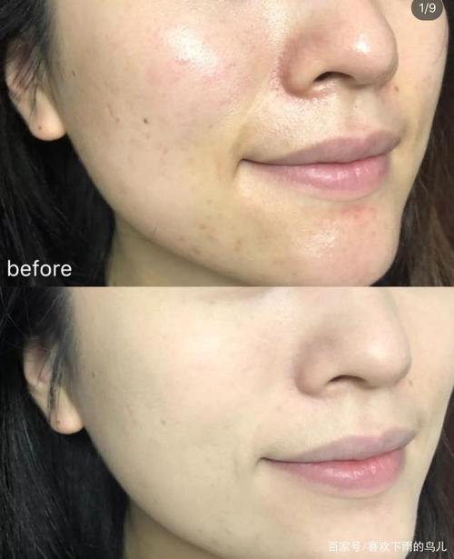 刘亦菲和陈都灵"生图"对比,谁皮肤更好,第五张图说明