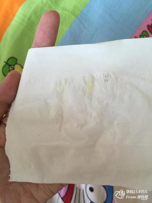 白带的正常颜色_正常白带与异常图片