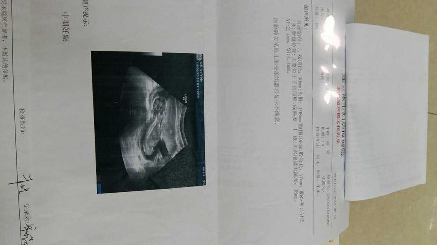 这个是三个月左右的普通b超.