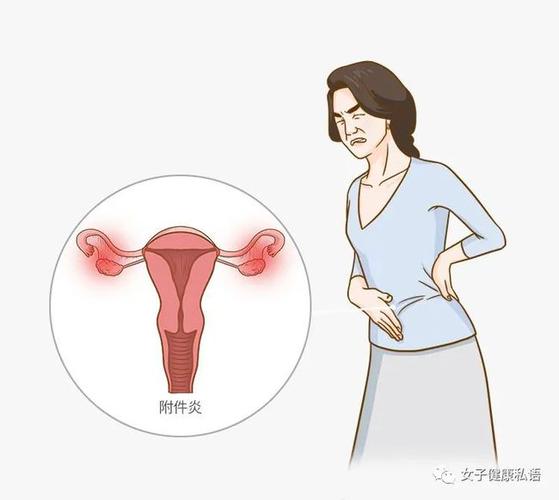 慢性附件炎以急性下腹痛为主,伴有发热,妇科检查时附件区有明显压痛和