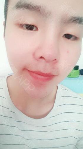 补齐照片,每篇5张全脸才能返现,被钱嫂撵回来了,我又要重新写