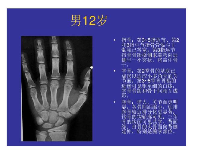 儿童骨龄对照图表