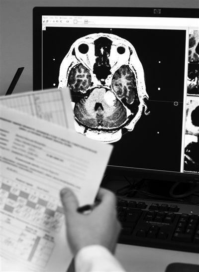 从《心术》看脑瘤治疗