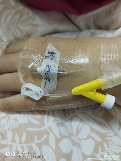 粤囧之中山医院第七天