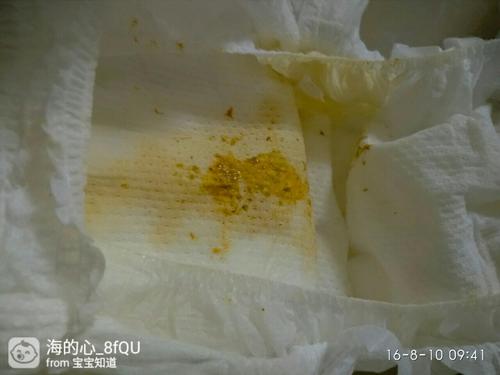 大便总是带水状正常吗