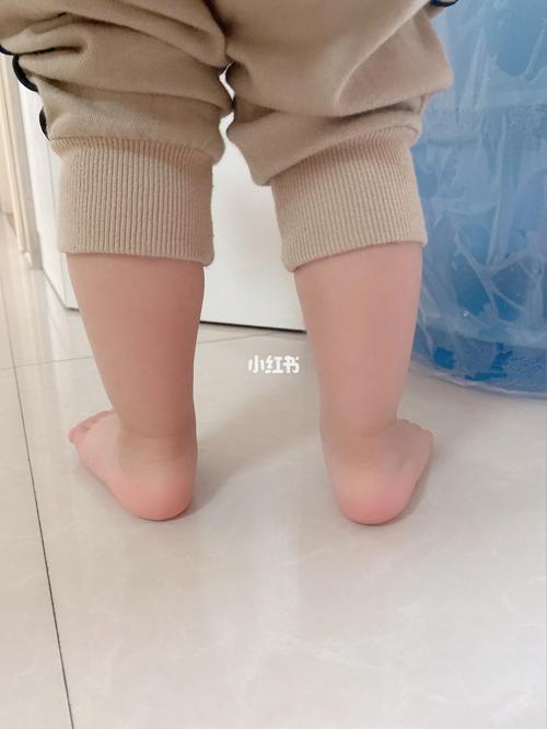 宝宝这是扁平足吗?足外翻怎么办?_家庭教育经验分享_母婴_育儿经验