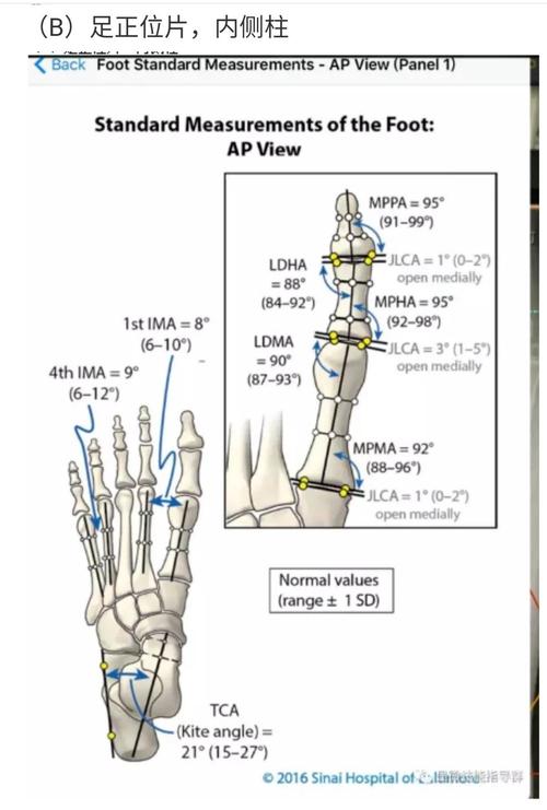 人体下肢力线和意义