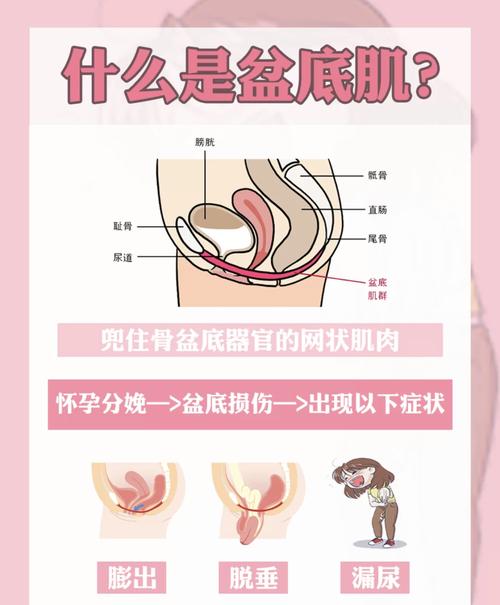 关于盆底肌修复你还再被人忽悠吗