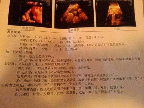 四维彩超的这些细节,其实已经透露了胎儿性别,孕妈你