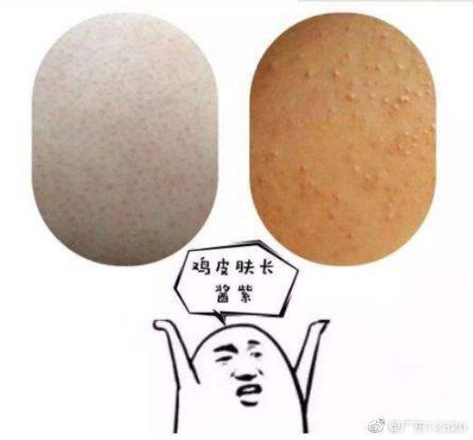 这种"鸡皮疙瘩"也许是病