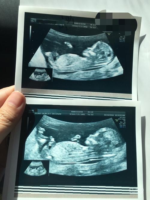 nt归来,有会看男女的亲吗?