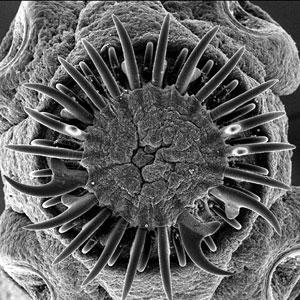 寄生虫控制大脑