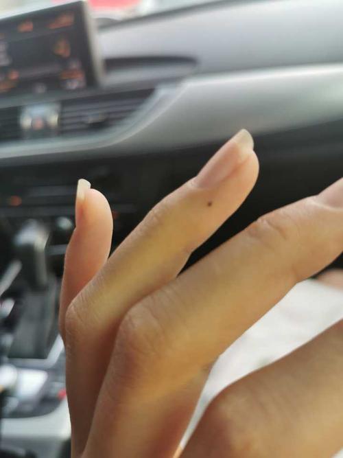 本人女左手无名指半年前多新长了一颗痣 有什么寓意?