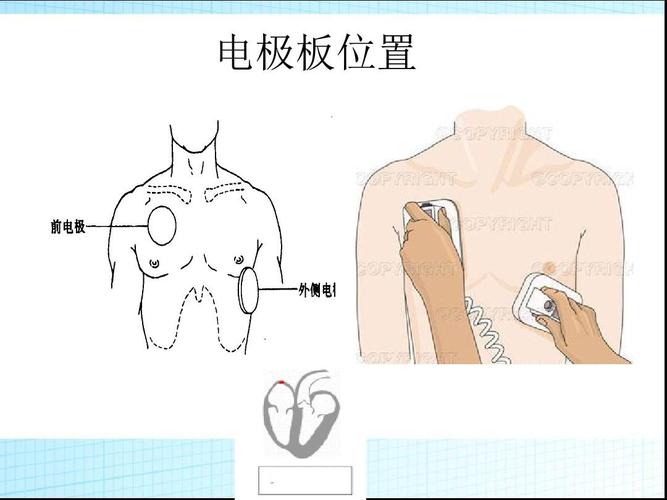 2015-心肺复苏新进展ppt