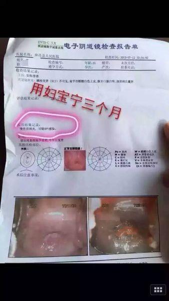 女人有hpv53高危怎么办