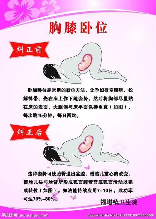 胸膝卧位图片