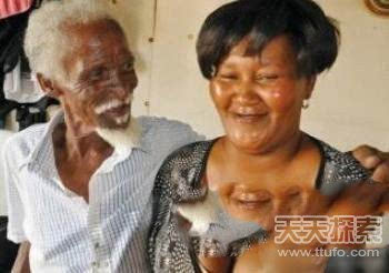 幼童屁股长尾巴 吓死人!盘点全球不可思议"怪胎"【组图】