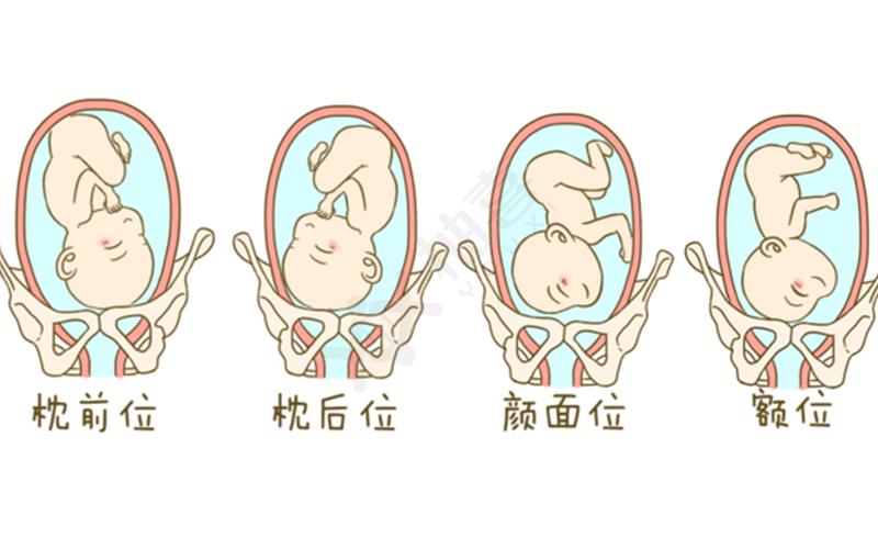 科普:胎位roa是什么意思,好不好顺产看了就知道
