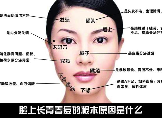 揭秘各个部位长痘痘的原因