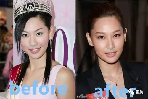 徐子珊|港姐|冠军_新浪女性_新浪网