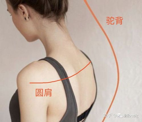怎样改善圆肩