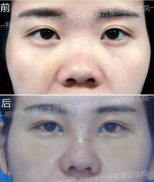 摆脱小猪鼻,人类已经无法阻止她炫自拍了!