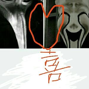 scp035和scp049