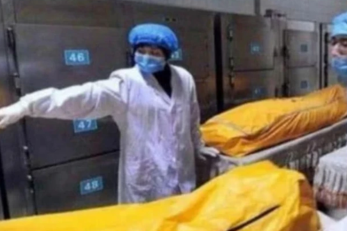 人死后,体内血液到底会流去哪里?医生的答案让你"头皮