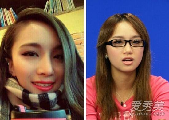 超女快女整容pk:江映蓉李媛希下巴超尖