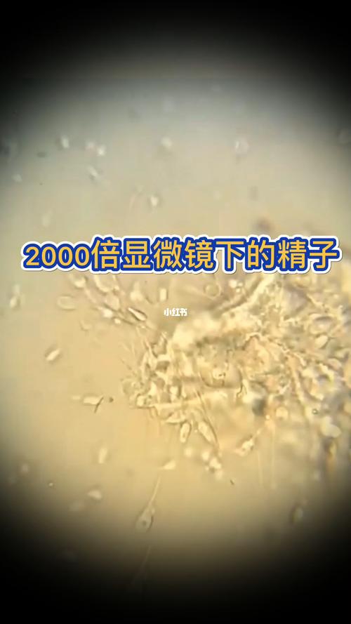 显微镜下的小蝌蚪放大_医疗健康_医疗健康其他