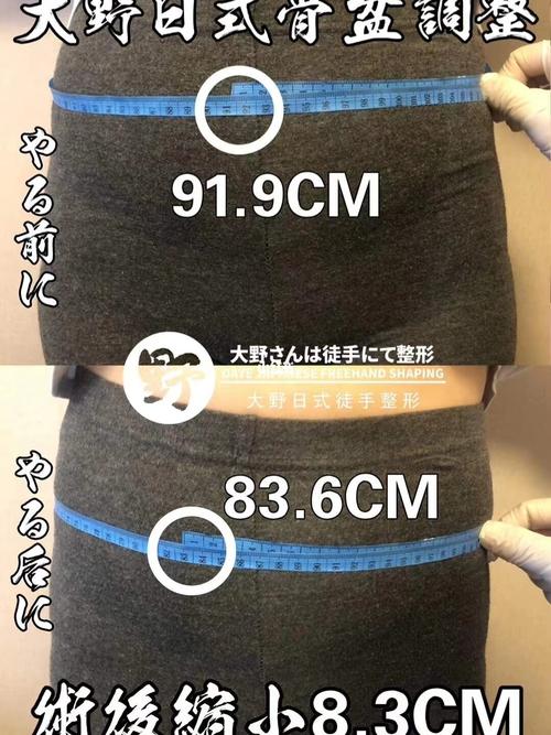 盆骨修复_骨盆_二胎_子宫_盆骨修复_母婴_妈妈经验