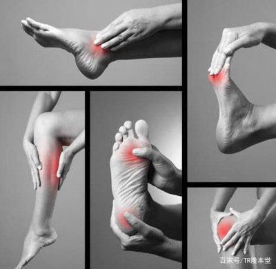 即可进行自测:痛风第一阶段症状:●没有明显痛风症状,但