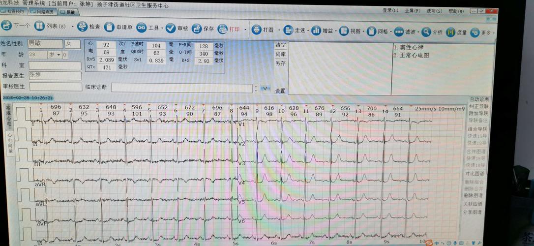 心电图图文数据