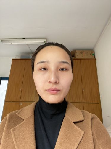 我脸大颧骨高显得脸特别老脸一边大一边小有什么补救的办法吗不想动