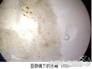 图4  显微镜下的水霉形态