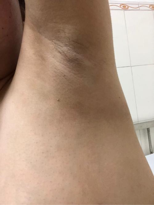 男孩可能性大78% 女孩可能性大22%          284 人参与