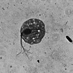 阴道毛滴虫(trichomonas vaginalis)