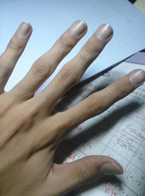 手指关节处略大.是关节炎之类的吗?