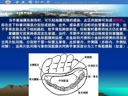 学 手的应用解剖(2009)ppt 当手掌指蹼处刺伤时,可引起指蹼间隙的感染