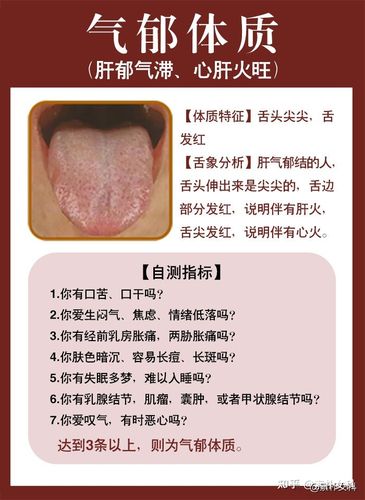 01 气郁体质(肝郁气滞,心肝火旺) 症状特点:性情急躁易怒,或忧郁寡欢