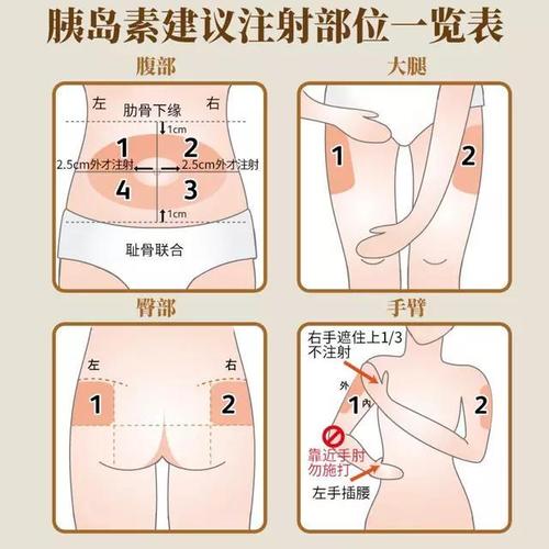 长期注射胰岛素,为什么肚子越来越大,血糖控制得越来越差?