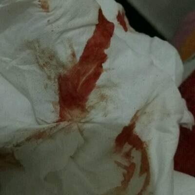 出了月子后排出的黄色恶露,后来突然又有了红色的,小肚子一阵阵难受